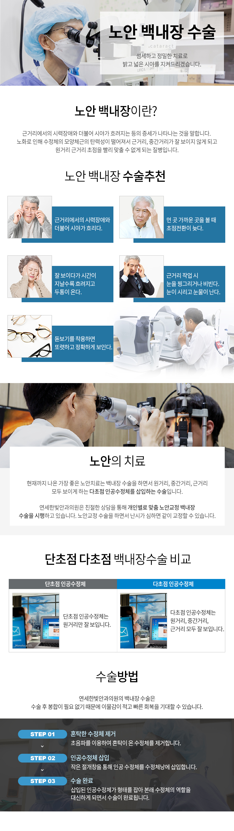노안백내장수술
