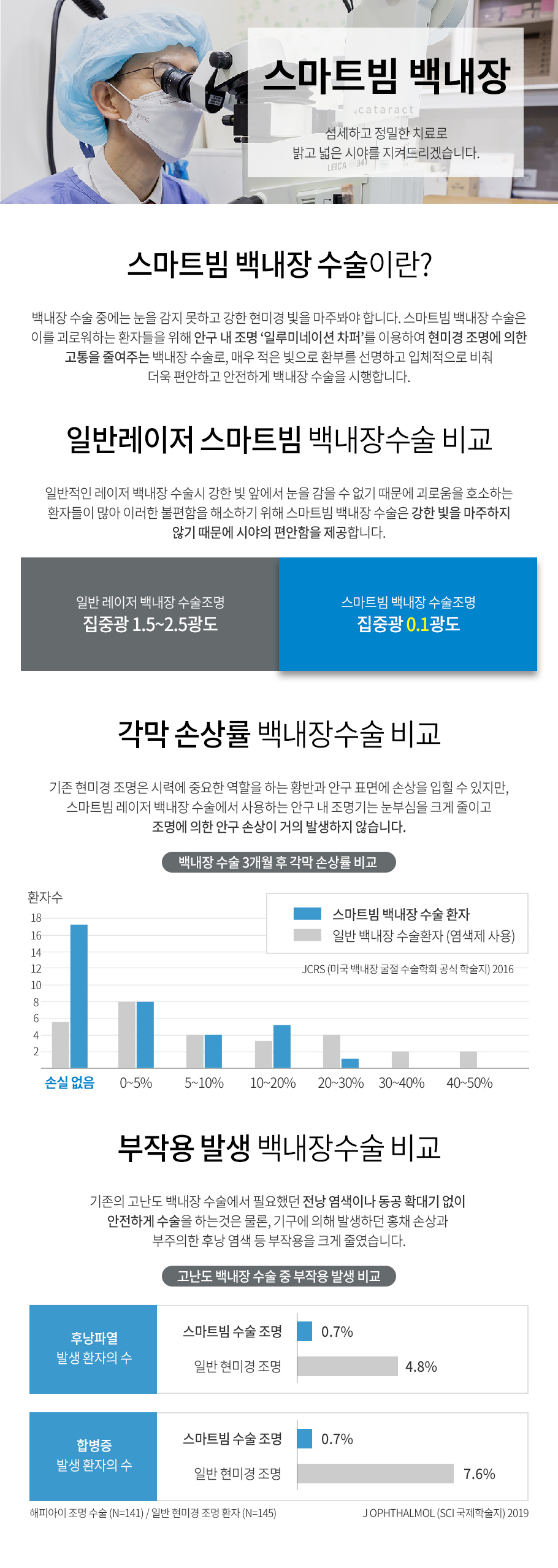 스마트빔백내장