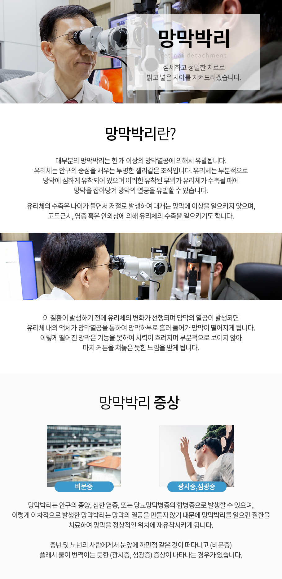 망막박리